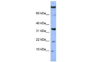WB Suggested Anti-FAM178B Antibody Titration: 0. (FAM178B antibody  (Middle Region))