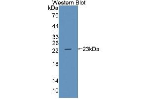 Western blot analysis of the recombinant protein. (ABCA9 antibody  (AA 1422-1589))