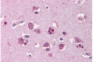 Human Brain, Cortex (formalin-fixed, paraffin-embedded) stained with HOMER1 antibody ABIN214115 at 5 ug/ml followed by biotinylated goat anti-rabbit IgG secondary antibody ABIN481713, alkaline phosphatase-streptavidin and chromogen. (HOMER1 antibody  (AA 101-150))