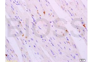Formalin-fixed and paraffin embedded mouse heart tissue labeled with Anti-Cathepsin K Polyclonal Antibody, Unconjugated (ABIN732038) at 1:200 followed by conjugation to the secondary antibody, (SP-0023), and DAB staining (Cathepsin K antibody)