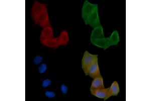 ABIN6259653 and ABIN6266917 staining Hela cells(24h of starvation treatment) by IF/ICC. (Serotonin Receptor 5A antibody  (Internal Region))