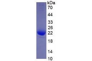 Image no. 1 for Interleukin 1, beta (IL1B) (AA 117-269) (Active) protein (His tag) (ABIN6239741) (IL-1 beta Protein (AA 117-269) (His tag))
