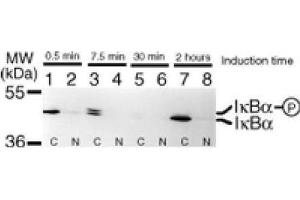 Western Blotting (WB) image for anti-Nuclear Factor of kappa Light Polypeptide Gene Enhancer in B-Cells Inhibitor, alpha (NFKBIA) (AA 32-291) antibody (ABIN2668625)