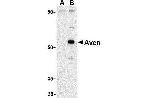 Western blot analysis of Aven in Raji cell lysate with AP30098PU-N Aven antibody at 1 μg/ml in (A) the presence and (B) the absence of blocking peptide.