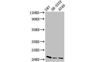 Western Blot Positive WB detected in: U87 whole cell lysate, SH-SY5Y whole cell lysate, A549 whole cell lysate All lanes: NDUFS4 antibody at 2.