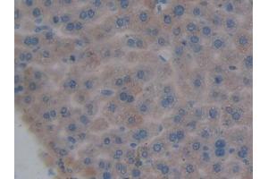 IHC-P analysis of Mouse Liver Tissue, with DAB staining.
