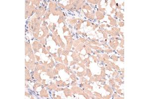 Immunohistochemistry of paraffin-embedded human stomach using ABCC1 antibody (ABIN6291733) at dilution of 1:100 (40x lens). (ABCC1 antibody)