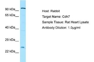 WB Suggested Anti-Cdh7 Antibody   Titration: 1. (Cadherin 7 antibody  (N-Term))