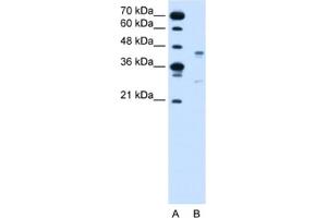 Western Blotting (WB) image for anti-G Protein-Coupled Receptor 161 (GPR161) antibody (ABIN2462573) (GPR161 antibody)
