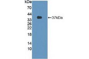 Detection of Recombinant FLII, Human using Polyclonal Antibody to Flightless I Homolog (FLII) (FLII antibody  (AA 896-1176))