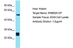 Host: Rabbit Target Name: FAM90A12P Sample Tissue: Human A549 Whole Cell Antibody Dilution: 1ug/ml (FAM90A12P antibody  (Middle Region))