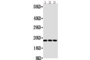 Anti-CD90/Thy1 antibody,  Western blotting Lane 1: Rat Brain Tissue Lysate Lane 2: Rat Liver Tissue Lysate Lane 3: Rat Thymus Tissue Lysate (CD90 antibody  (N-Term))