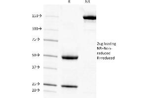 SDS-PAGE Analysis Purified AMPD3 Mouse Monoclonal Antibody (AMPD3/901).