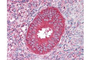 Anti-CDX2 antibody IHC of human uterus.