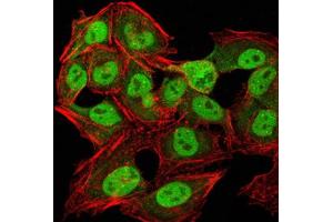 Immunocytochemistry (ICC) image for anti-Chromobox Homolog 1 (CBX1) (AA 1-185) antibody (ABIN5890956) (CBX1 antibody  (AA 1-185))