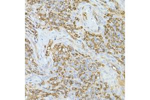 Immunohistochemistry of paraffin-embedded human tonsil using C Rabbit mAb (ABIN7266058) at dilution of 1:50 (40x lens). (CAP1 antibody)