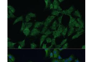 Immunofluorescence analysis of C6 cells using DDX3Y Polyclonal Antibody at dilution of 1:100 (40x lens). (DDX3Y antibody)