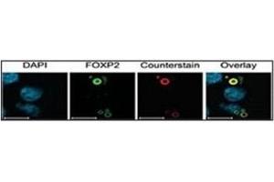Image no. 5 for anti-Ubiquitin (Ub) (AA 36-66) antibody (ABIN3029420)