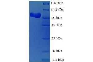 SDS-PAGE (SDS) image for Polymerase (DNA Directed), gamma (POLG) (AA 575-866) protein (His-SUMO Tag) (ABIN4976674)