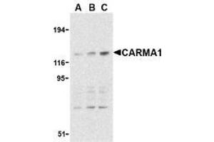 Western blot analysis of CARMA1 expression in mouse thymus cell lysate with AP30186PU-N CARMA1 antibody at 0. (CARD11 antibody)