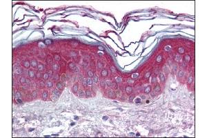 Image no. 1 for anti-rho Guanine Nucleotide Exchange Factor (GEF) 11 (ARHGEF11) (AA 1-50), (N-Term) antibody (ABIN372272) (ARHGEF11 antibody  (N-Term))