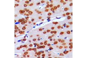 Immunohistochemical analysis of GPRIN2 staining in human brain formalin fixed paraffin embedded tissue section. (GPRIN2 antibody  (N-Term))