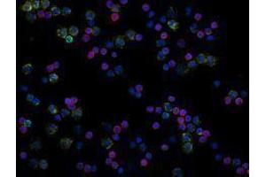 Immunofluorescence (IF) image for anti-CD3 (CD3) antibody (Alexa Fluor 594) (ABIN2656823) (CD3 antibody  (Alexa Fluor 594))