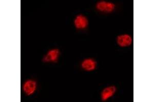 ABIN6275323 staining MCF7 by IF/ICC. (NXF3 antibody  (N-Term))