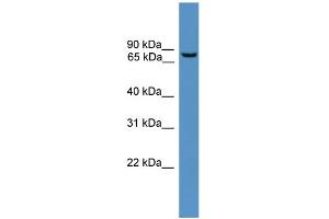 WB Suggested Anti-BBS2 Antibody Titration: 1.