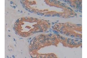 Immunohistochemistry (IHC) image for anti-Kallikrein 2 (KLK2) (AA 19-261) antibody (ABIN7435352)