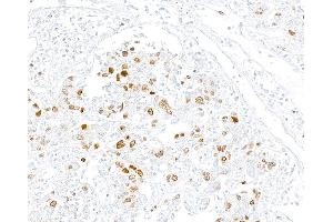 Immunohistochemistry (IHC) image for anti-Topo IIalpha (AA 650-700) antibody (ABIN7795795) (Recombinant Topo IIalpha (AA 650-700) antibody)