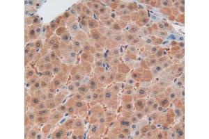Used in DAB staining on fromalin fixed paraffin- embedded liver tissue (CNTNAP1 antibody  (AA 926-1190))