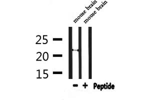 Western blot analysis of extracts from mouse brain, using FGF20 Antibody. (FGF20 antibody  (Internal Region))