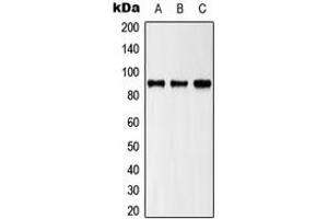 Western blot analysis of ZAK expression in HeLa (A), HepG2 (B), NIH3T3 (C) whole cell lysates. (ZAK antibody  (C-Term))