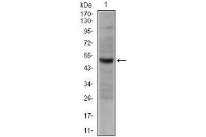 Western blot analysis using CD30 mouse mAb against Hela cell lysate.