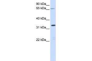 WB Suggested Anti-C19orf47 Antibody Titration:  0. (C19orf47 antibody  (Middle Region))