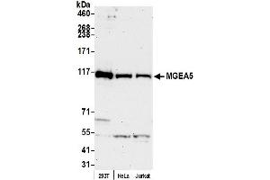 Western Blotting (WB) image for anti-Meningioma Expressed Antigen 5 (Hyaluronidase) (MGEA5) (AA 500-550) antibody (ABIN7453549)
