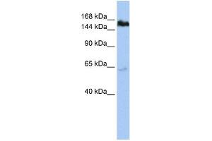 WB Suggested Anti-TNKS Antibody Titration:  1 ug/ml  Positive Control:  HepG2 cell lysate (TNKS antibody  (Middle Region))