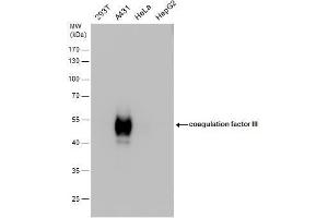 WB Image Tissue factor antibody detects Tissue factor protein by western blot analysis. (Tissue factor antibody)