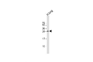 Western Blot at 1:2000 dilution + human lung lysate Lysates/proteins at 20 ug per lane. (MXI1 antibody  (AA 53-82))