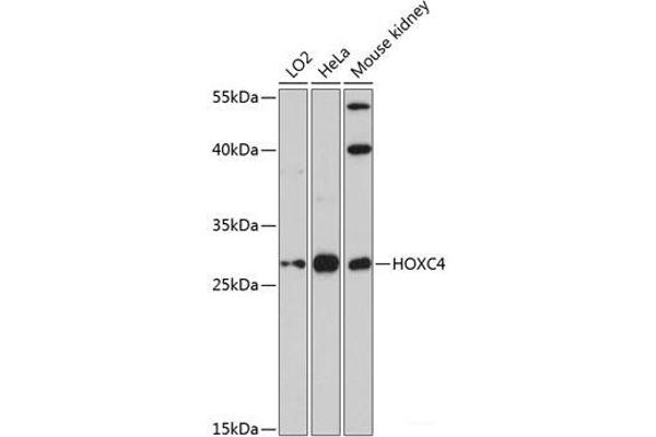 HOXC4 抗体