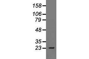 Western blot analysis of 35 µg of cell extracts from human Liver carcinoma (HepG2) cells using anti-TNNI3 antibody. (TNNI3 antibody)