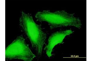 Immunofluorescence of purified MaxPab antibody to TAF8 on HeLa cell. (TAF8 antibody  (AA 1-174))