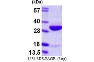 HMGB2 Protein (AA 1-209) (His tag)
