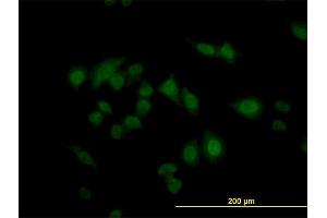 Immunofluorescence of monoclonal antibody to CARF on HeLa cell. (CDKN2AIP antibody  (AA 1-579))