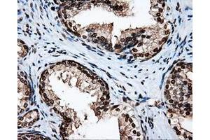 Image no. 3 for anti-Amyloid beta (A4) Precursor Protein (APP) antibody (ABIN1496877) (APP antibody)