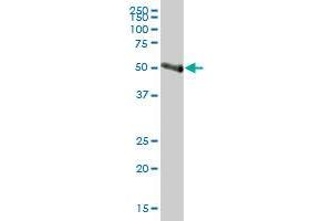 IL1R2 antibody  (AA 1-398)