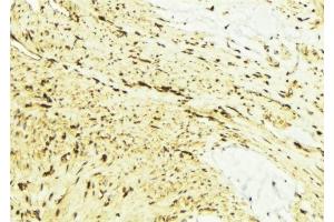 ABIN6276577 at 1/100 staining Mouse muscle tissue by IHC-P.