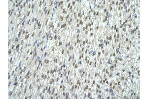 Rabbit Anti-EXOSC7 antibody   Paraffin Embedded Tissue: Human Heart cell Cellular Data: cardiac cell of renal tubule Antibody Concentration: 4. (EXOSC7 antibody  (N-Term))
