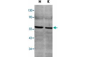 Western blot analysis of TNFRSF10B in HeLa (H) and K-562 (K) cell lysates with TNFRSF10B polyclonal antibody  at 2 ug/mL . (TNFRSF10B antibody  (C-Term))